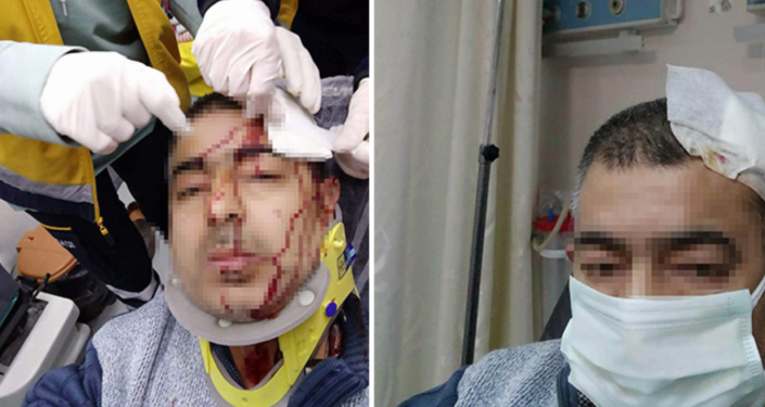 İmamın tabureyle saldırdığı müezzinin başına 10 dikiş atıldı